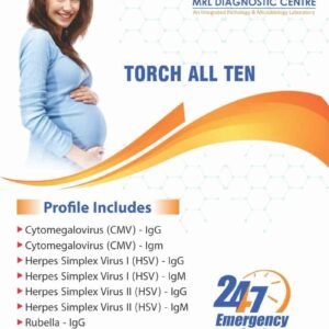 Torch All Ten Profile