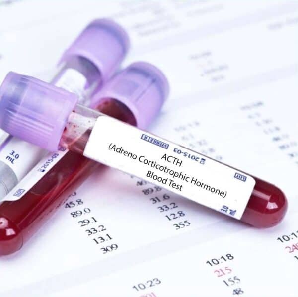 ACTH (ADRENO CORTICOTROPHIC HORMONE)