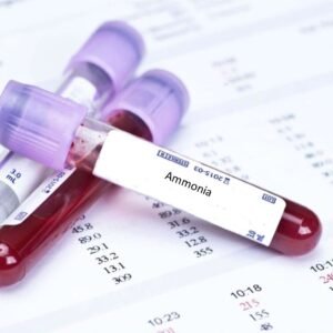 Ammonia Blood Test