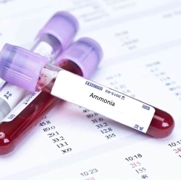 Ammonia Blood Test