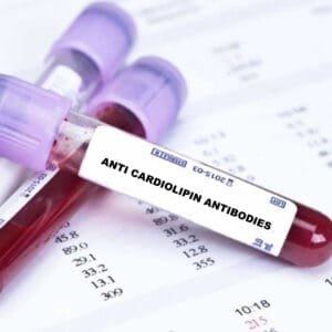 Anti Cardiolipin Test