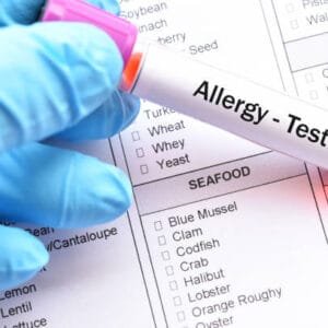 Allergy Test