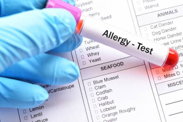 Allergy Test