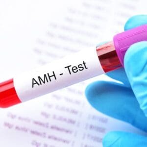 Anti-Müllerian Hormone Test