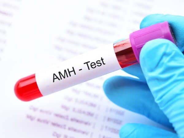 Anti-Müllerian Hormone Test