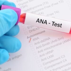 ANA ( ANTI NUCLEAR ANTIBODY)