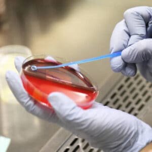 Blood Culture & Sensitivity