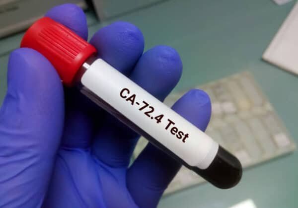 CA 72.4 Marker Test