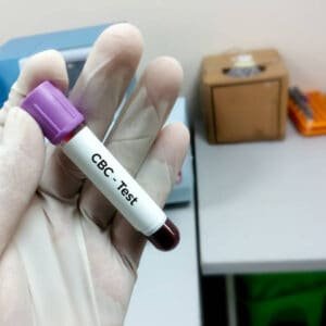 CBC 6 Level Blood Test