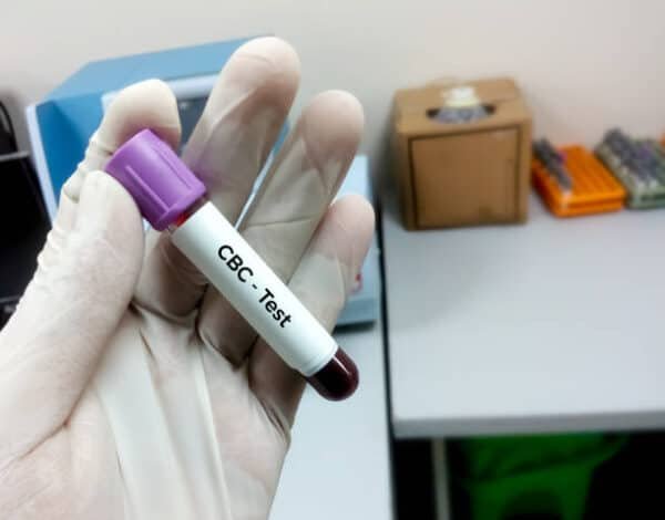 CBC 6 Level Blood Test