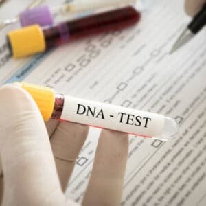 DS DNA Test