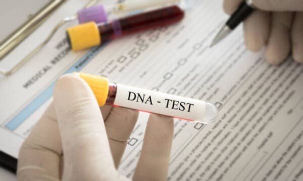 DS DNA Test