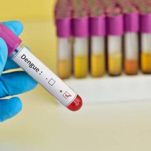 Dengue Antibodies IgG, Serum (ELISA)