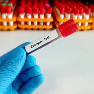 E2 Estradiol Test