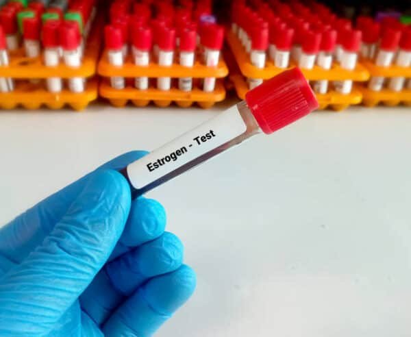 E2 Estradiol Test