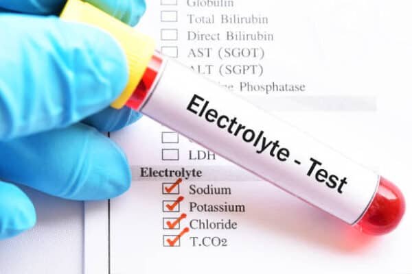 Electrolyte Test