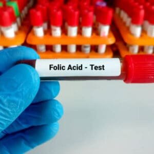 Folic Acid Test