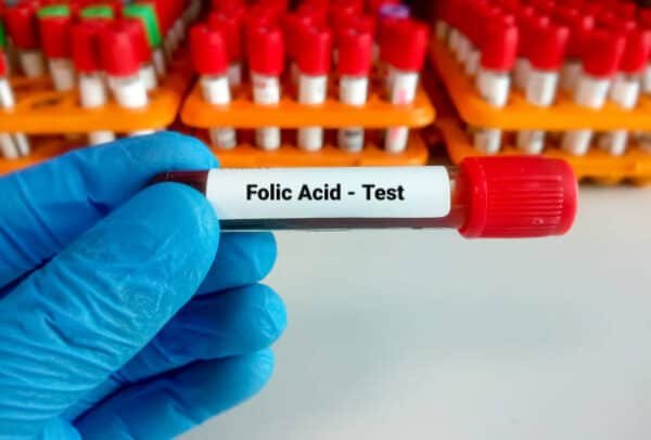 Folic Acid Test