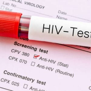 HIV Test