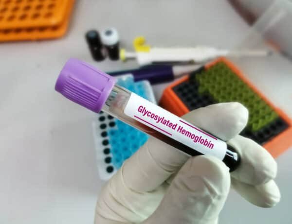 HbA1C (Glycosylated Haemoglobin)