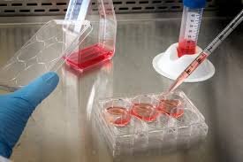 Histopathology Test