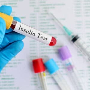 Insulin Fasting Test