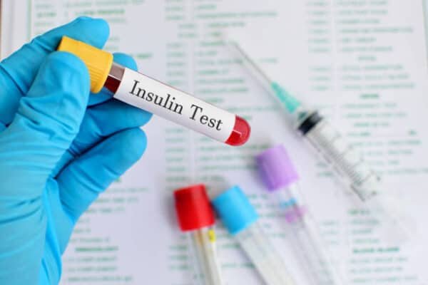 Insulin Fasting Test