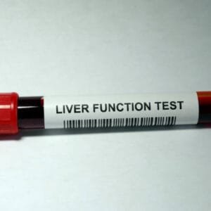 LFT - Liver Function Test