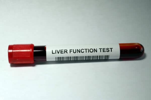 LFT - Liver Function Test