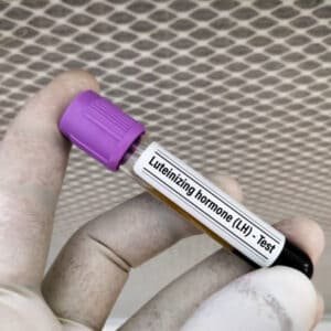 Luteinizing Hormone Test