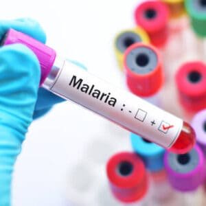 Malarial Parasite Antigen Test