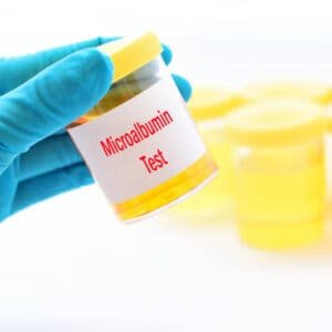 Microalbumin Test