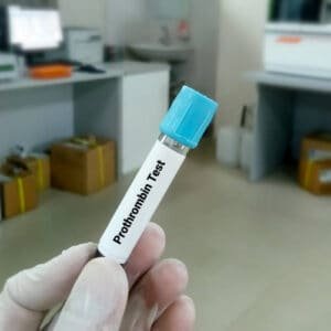 PT - Prothrombin Time Plasma Test