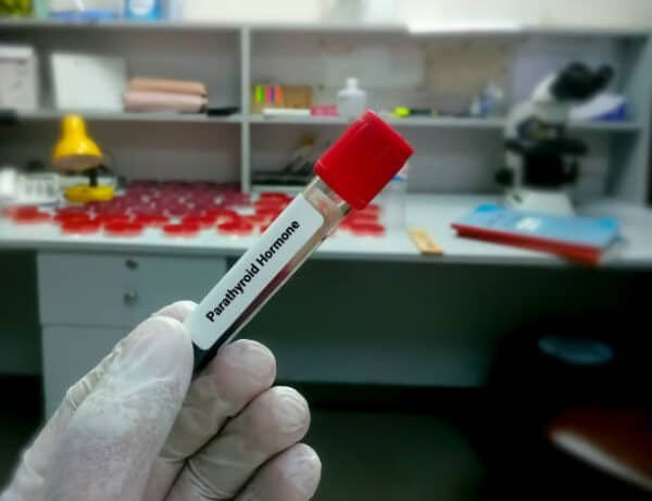 Parathyroid Hormone PTH Test