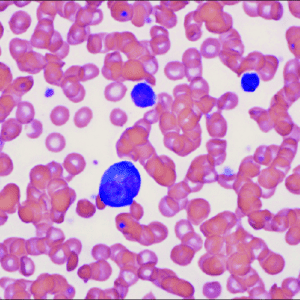 Peripheral Smear Examination