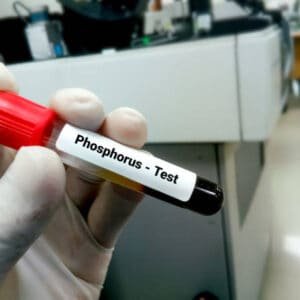 Phosphorus (Inorganic) Serum Test