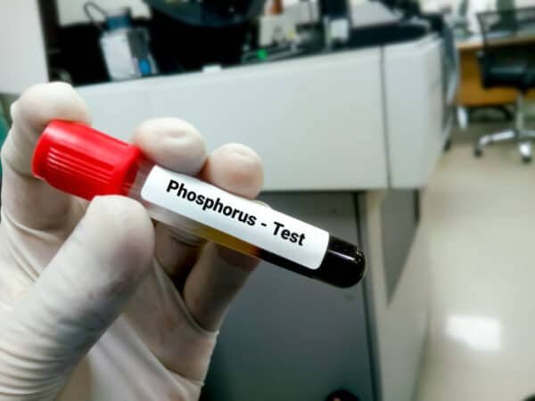 Phosphorus (Inorganic) Serum Test