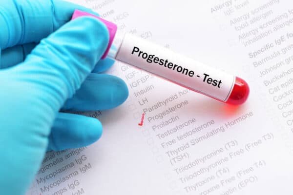 Progesterone Serum Test