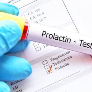 Prolactin Serum Test