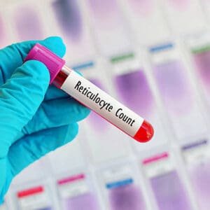 Reticulocyte Count Blood Test