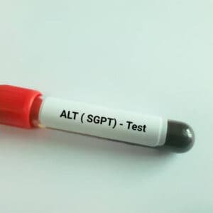 SGPT Test