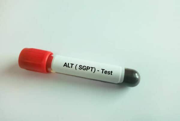 SGPT Test