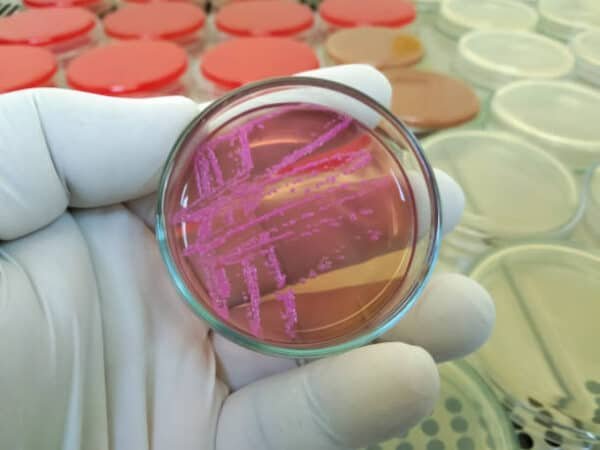 Stool Culture & Sensitivity Test