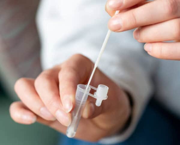 Swab Culture & Sensitivity