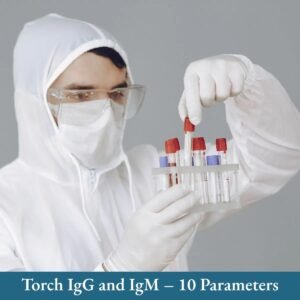 TORCH PANEL Igm & Igg