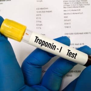 TROPONIN I (Quantitative) Test