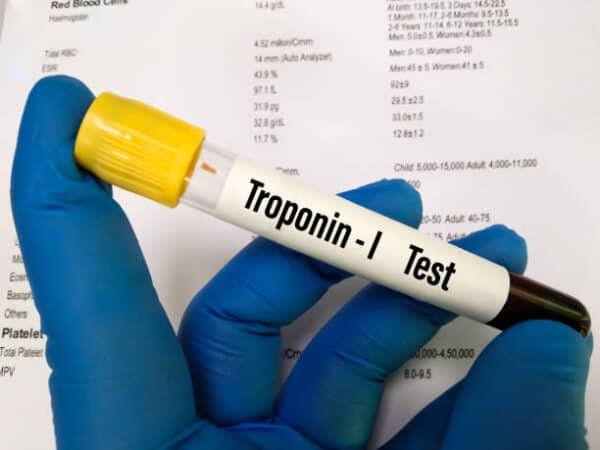 TROPONIN I (Quantitative) Test