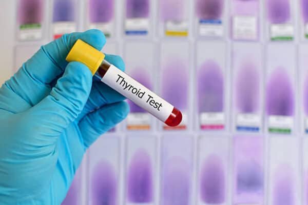 Thyroid Function Test