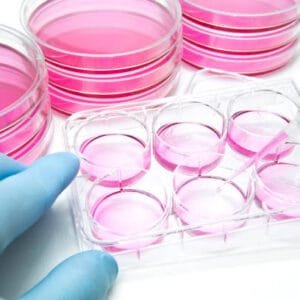 Tissue Culture And Sensitivity Test