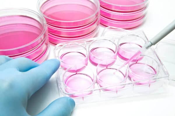 Tissue Culture And Sensitivity Test